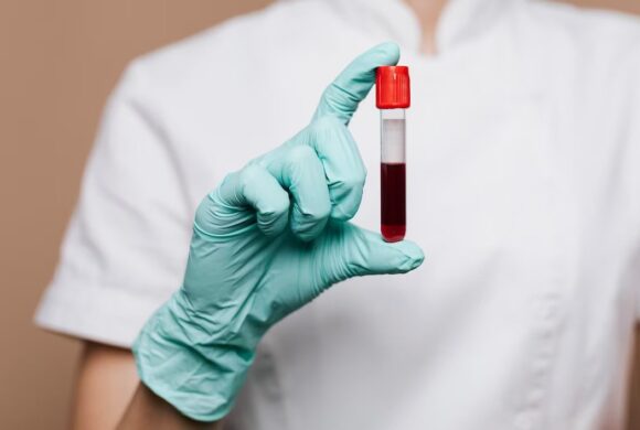 Can Blood be Considered Infectious in its original state?